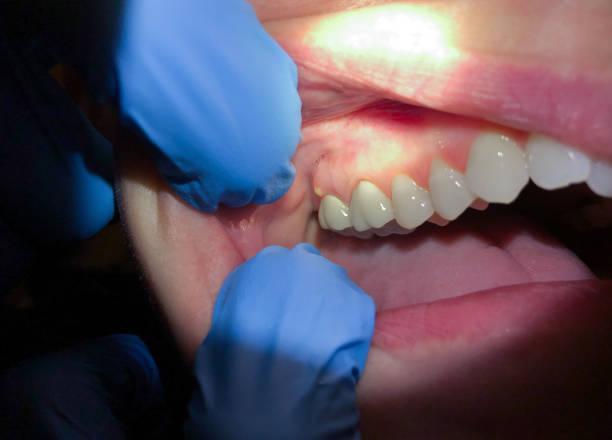 Best Orthodontic Emergency Dentist in Carrollton, AL